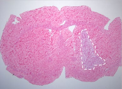 Micrograph with outlined tumor for test of blood-brain barrier integrity in mouse pretreated with placebo